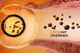 cholesterol是什么意思 - choleric是什么意思