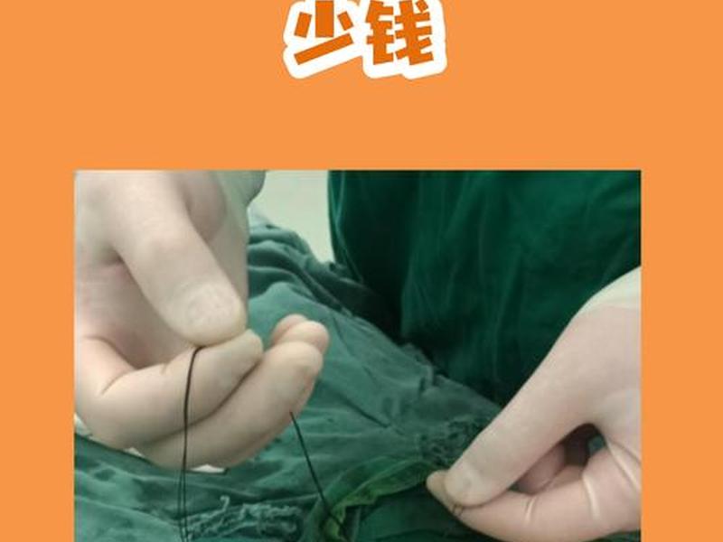 40岁还可以做手术吗、40岁还可以做手术吗多少钱 40岁还可以做手术吗、40岁还可以做手术吗多少钱