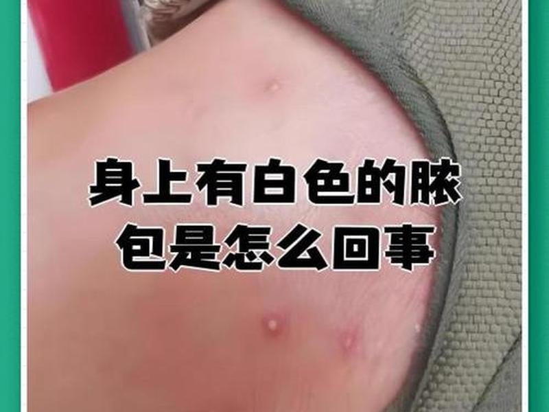 18岁女孩背后有脓包怎么回事、18岁女孩背后有脓包怎么回事啊 18岁女孩背后有脓包怎么回事、18岁女孩背后有脓包怎么回事啊