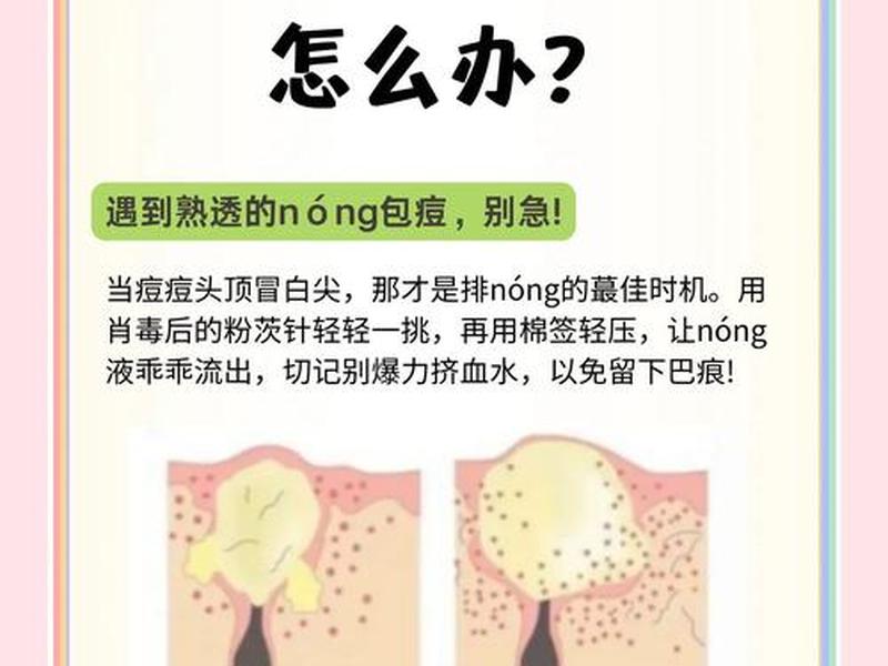 18岁女孩背后有脓包怎么回事,18岁女孩背后有脓包怎么回事啊 18岁女孩背后有脓包怎么回事,18岁女孩背后有脓包怎么回事啊